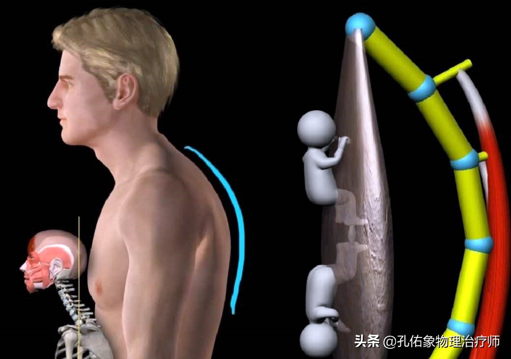 颈椎不好如何治疗最好,颈椎不好怎么预防和治疗