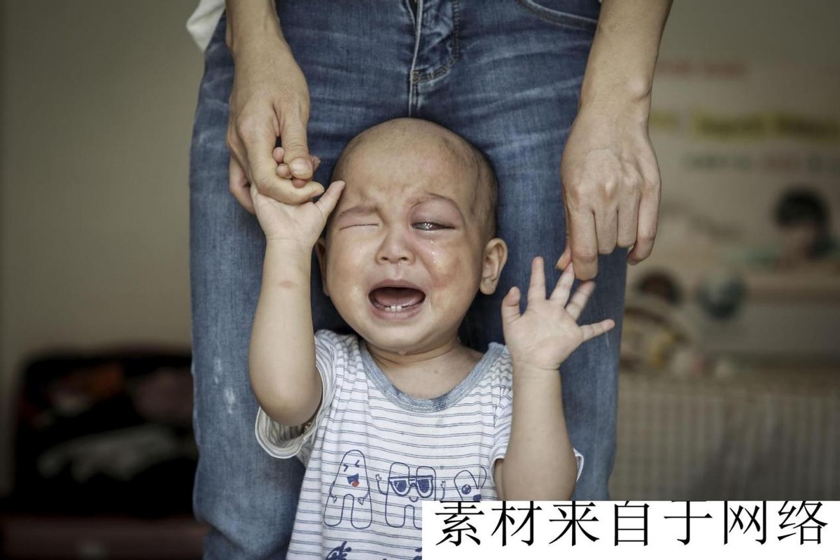 广西一男童出生玻璃眼,男婴出生37天双眼像玻璃珠
