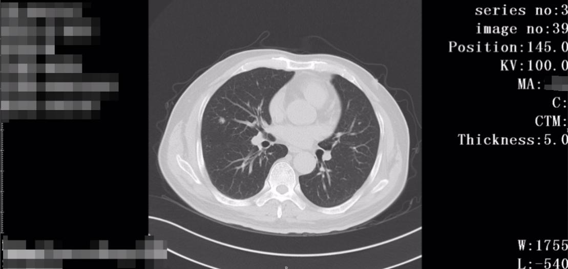 赵伯伯的最新视频,赵大爷患癌症