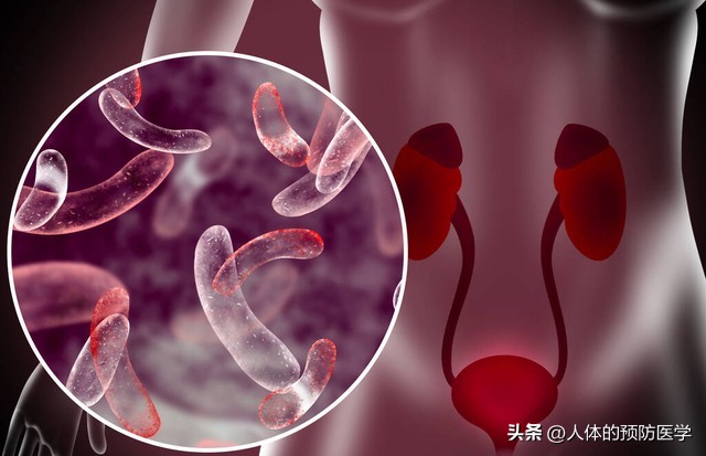 小便后有白色透明粘稠液吃什么药,小便白色的怎么回事吃什么药