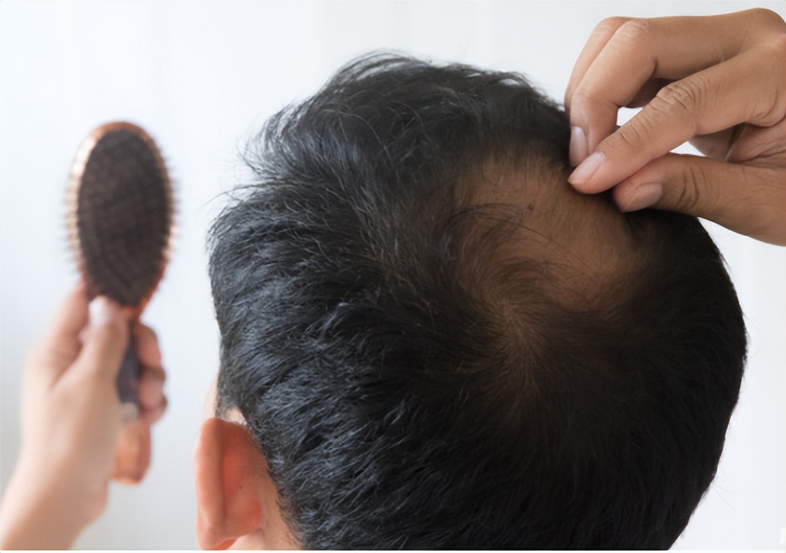 头皮里总是长疙瘩和脓包怎样治疗,头皮总长疙瘩和脓包是怎么回事