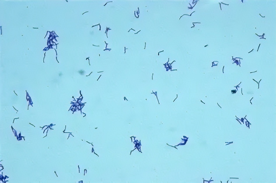 肠道中主要的有益菌及其生理功能,肠道革兰阴性杆菌为优势菌群