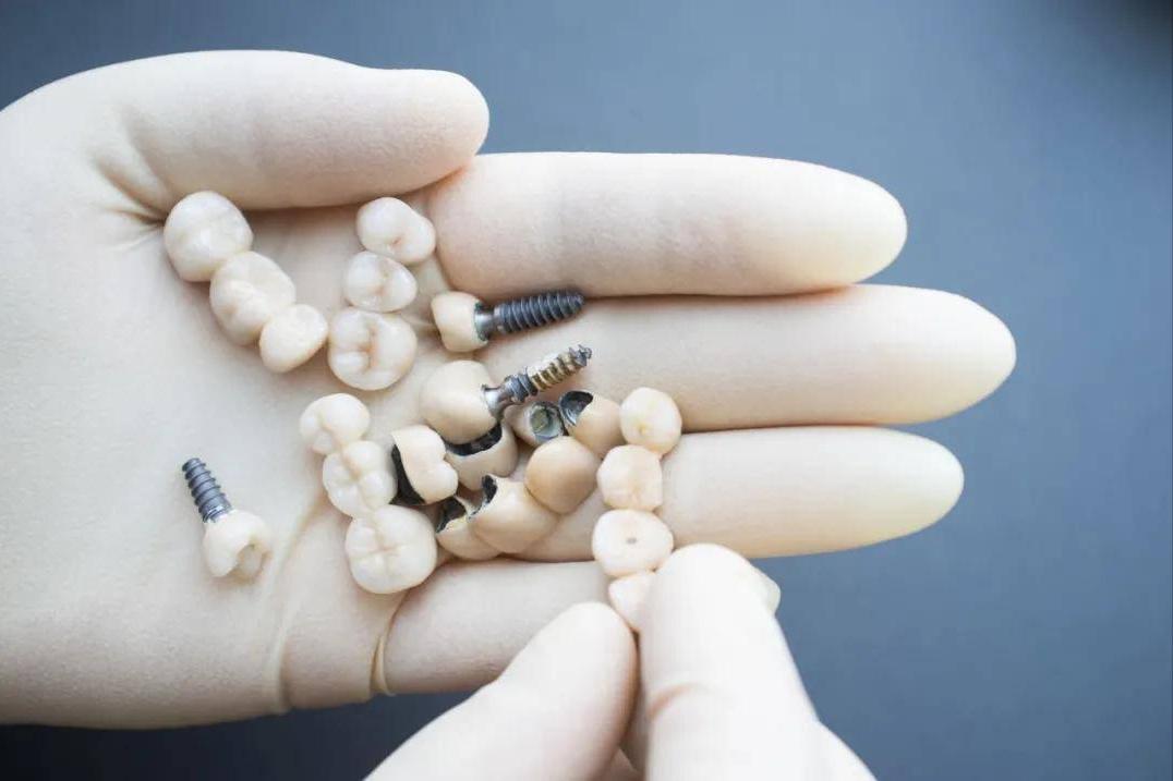 老年人如何防止掉牙,掉牙的老人怎么护理牙齿