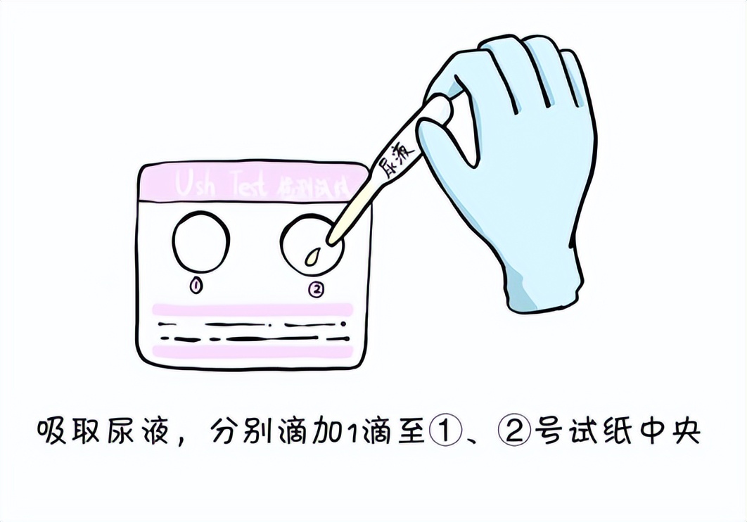 女性hpv阳性会影响怀孕吗,hpv35阳性能怀孕吗