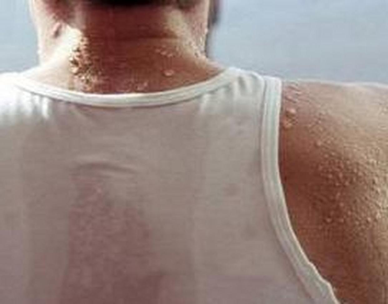 半夜出汗全身湿透是不是阳了,半夜出汗把被子都湿了是什么原因