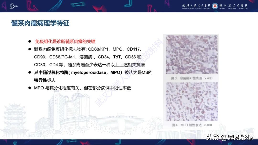 阴道肉瘤症状,阴道肉瘤的早期症状