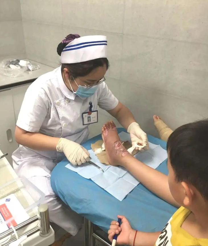 孩子被开水烫伤后续,孩子被开水烫伤后该如何处理