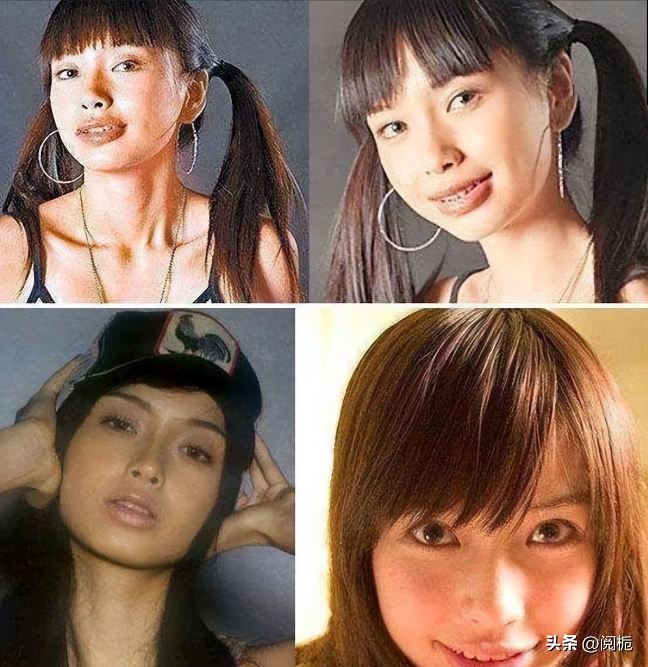 靠换脸逆天改命的六位女星,长得歪瓜裂枣整得美若天仙的明星