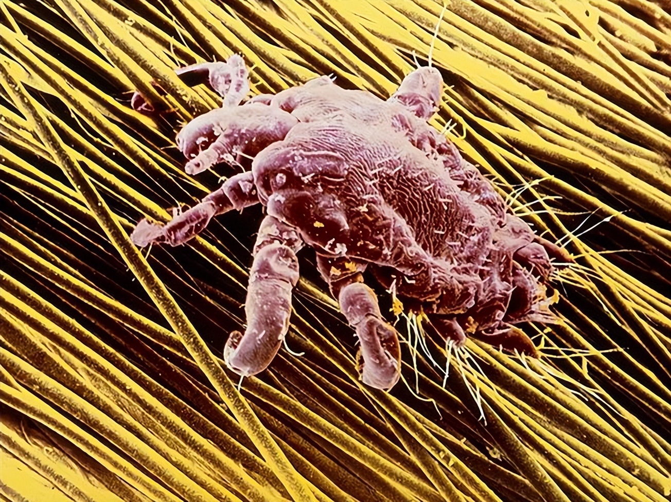 男子腹部痒,男性大量阴虱和虫卵