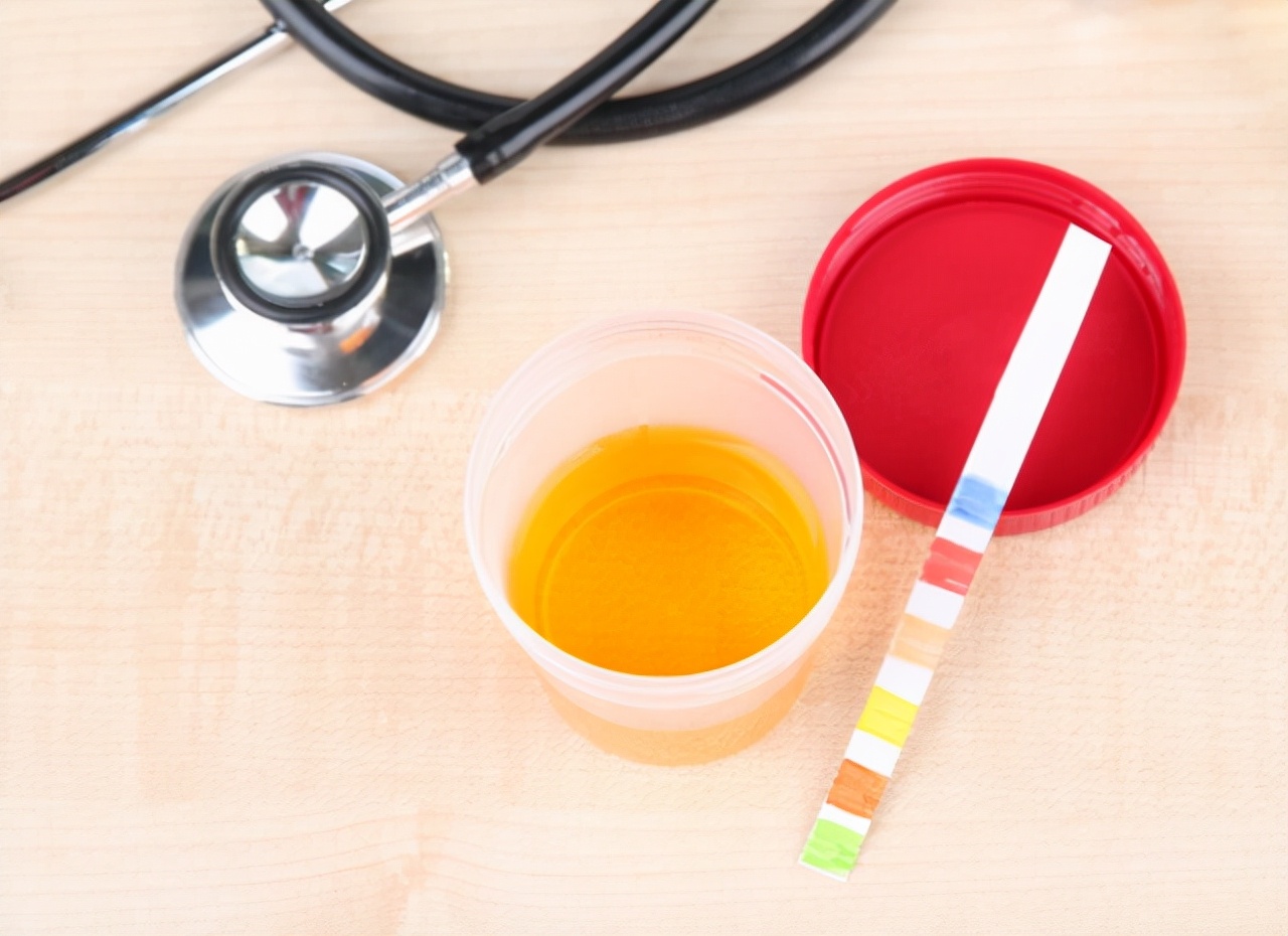 尿酸高上厕所症状,尿酸高上厕所有什么反应