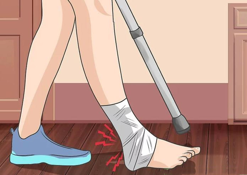 骨折后正确使用拐杖方法,骨折后打石膏怎么使用拐杖