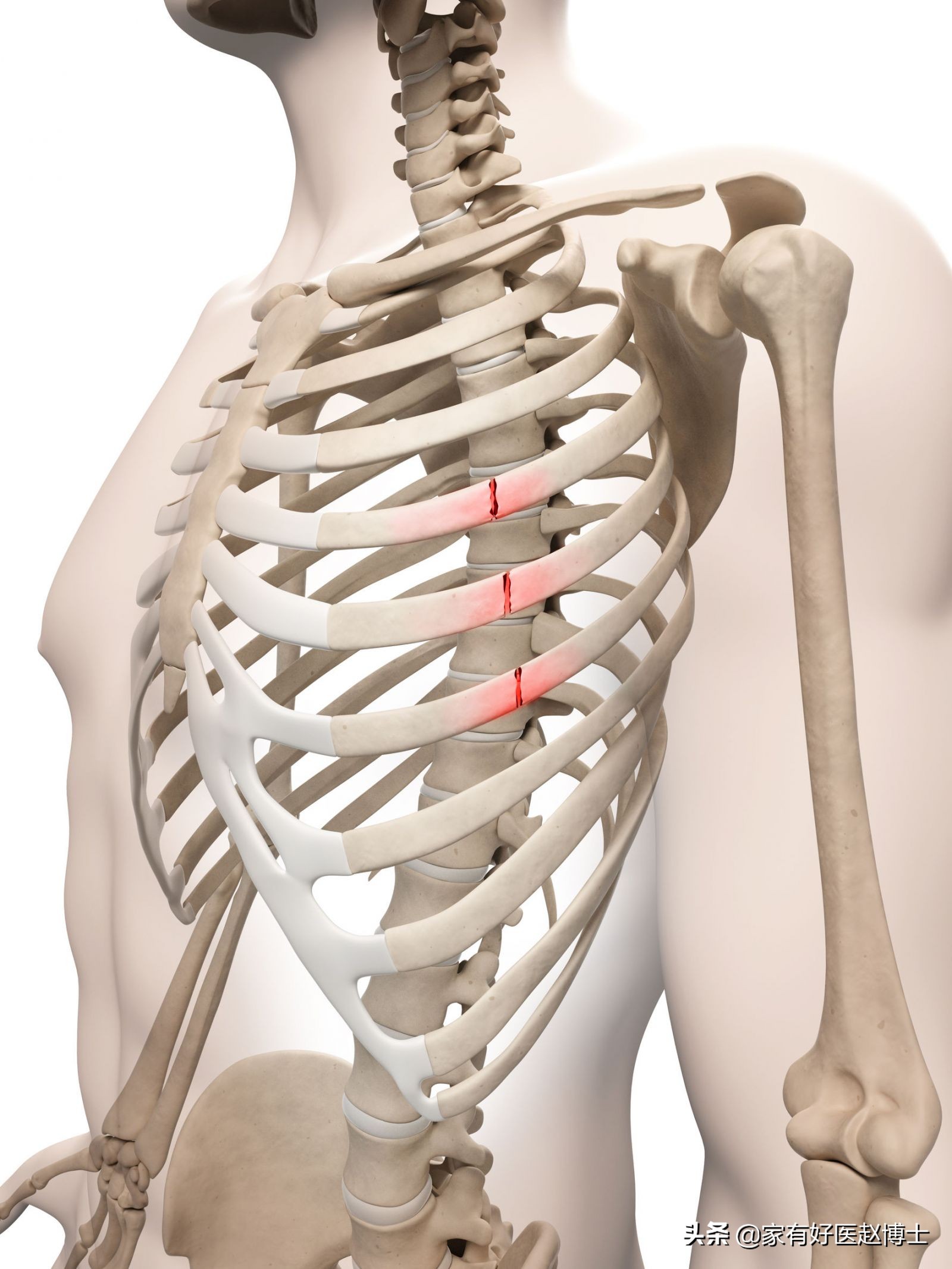 急性心梗发作的急救方法,急性心梗与非急性心梗有什么区别