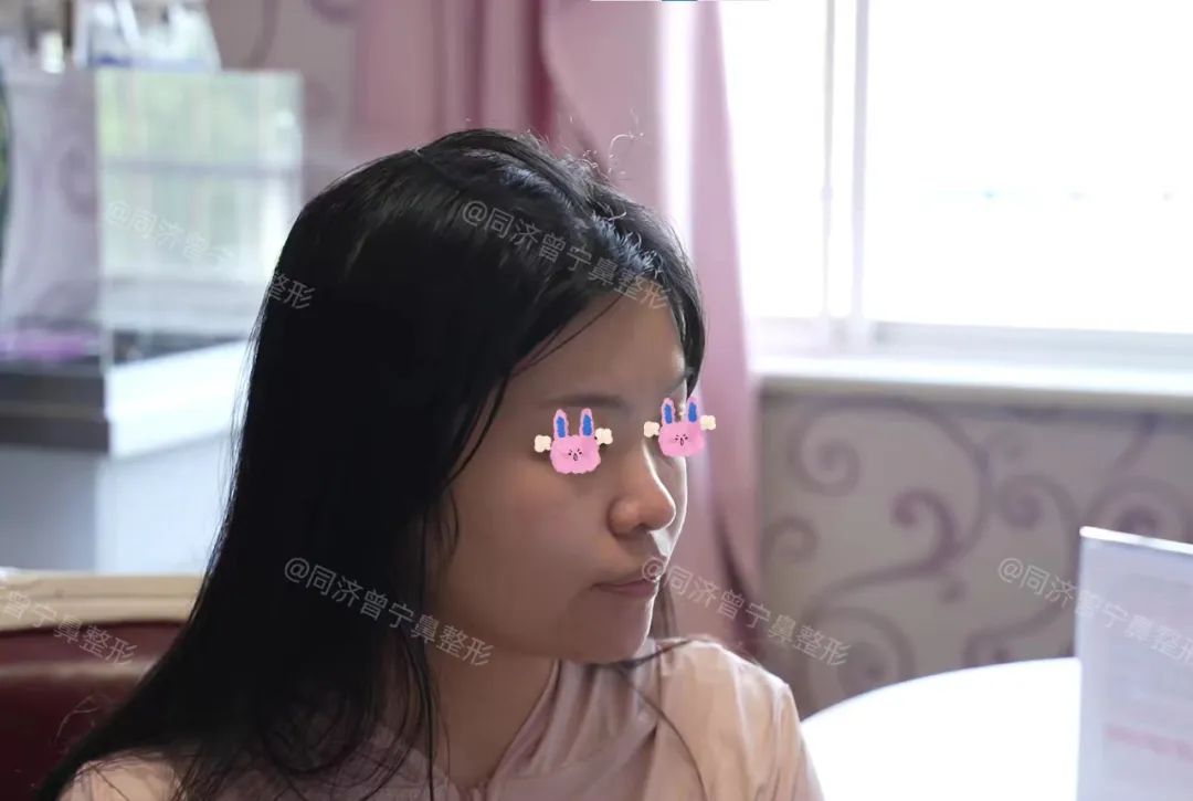 鼻子小五官紧凑怎么修容,怎么让鼻子立体精致