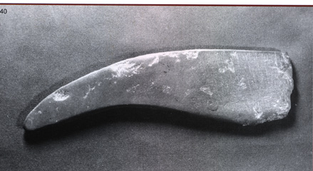 古代西医有多荒诞？华盛顿，莫扎特都死于放血疗法！