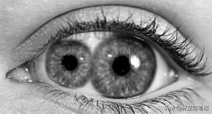 双瞳孔的真实照片,有没有双瞳孔的人