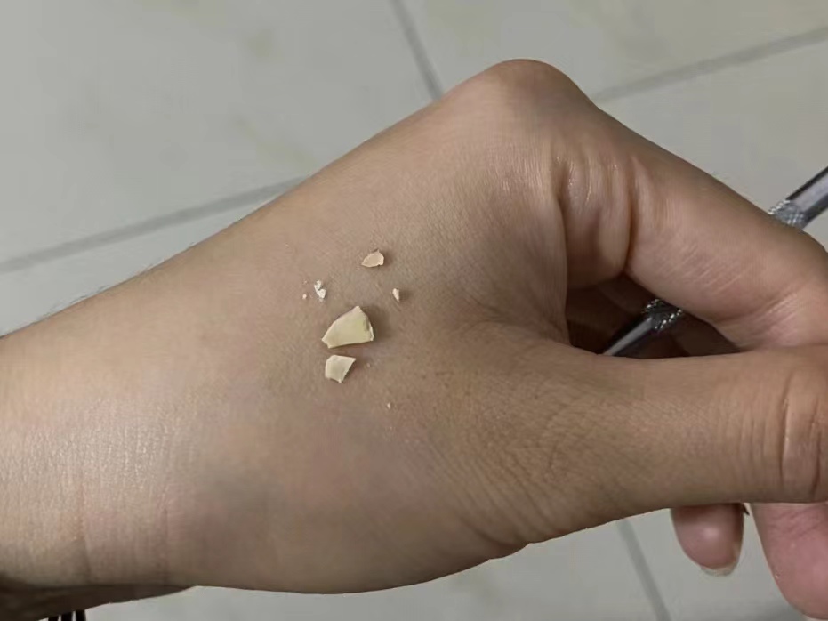 消除牙结石3个偏方轻松去除,5分钟快速去除牙结石