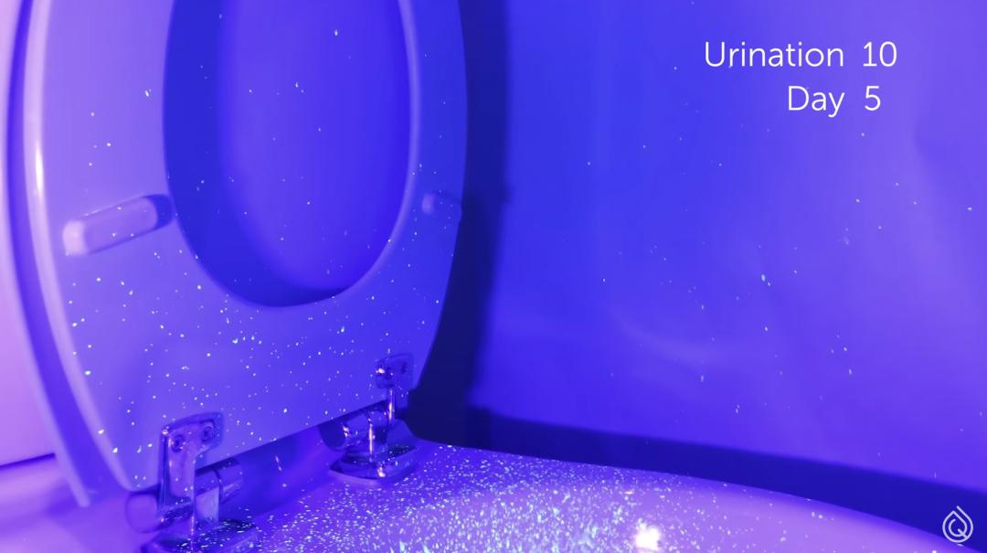 被公厕水溅到会得淋病吗,被公厕水溅到会感染吗