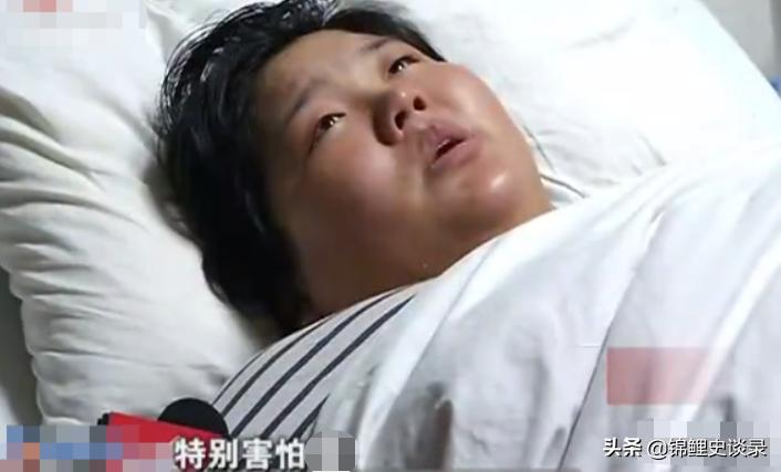 罕见260斤孕妇安徽,260斤巨婴孕妇