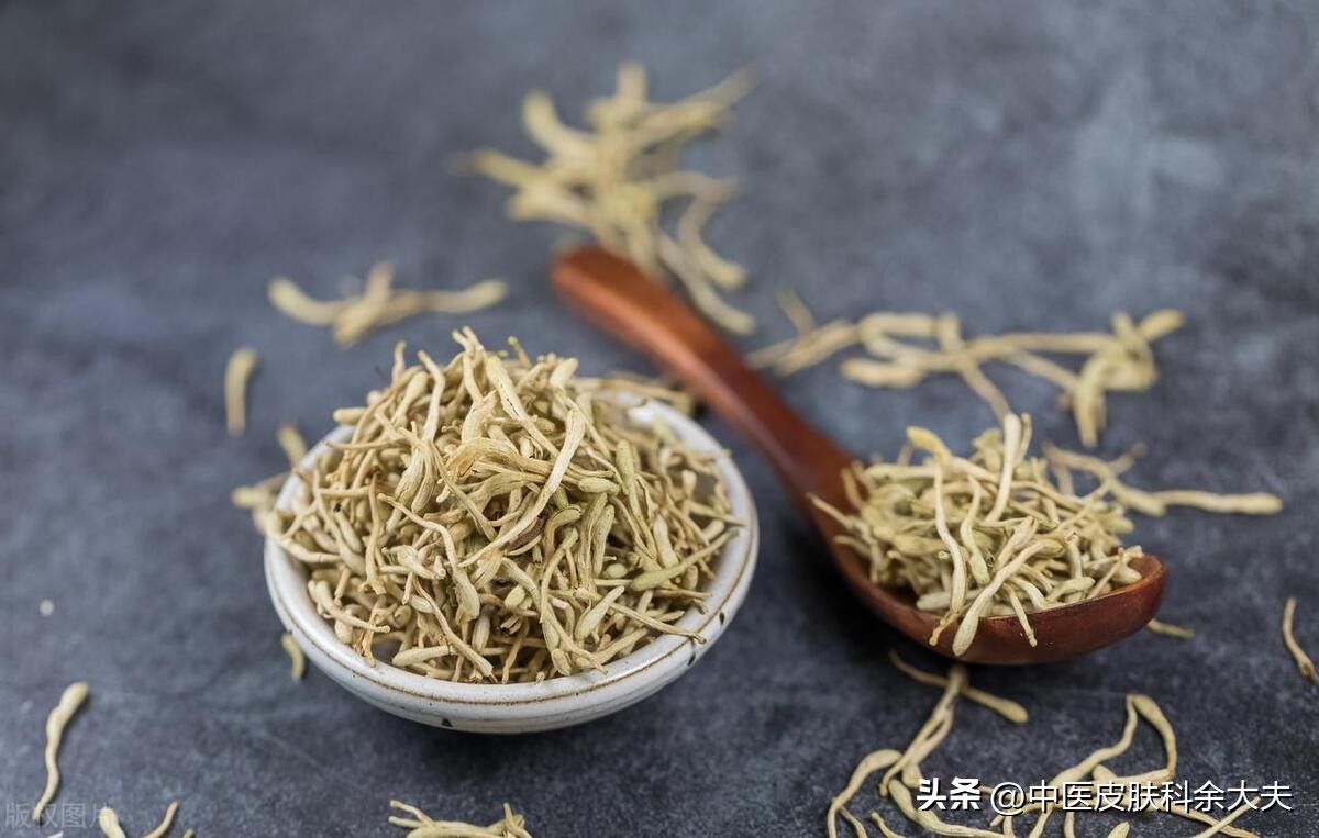 荨麻疹带有荆芥的药方,银翘散治疗胆碱性荨麻疹的案例