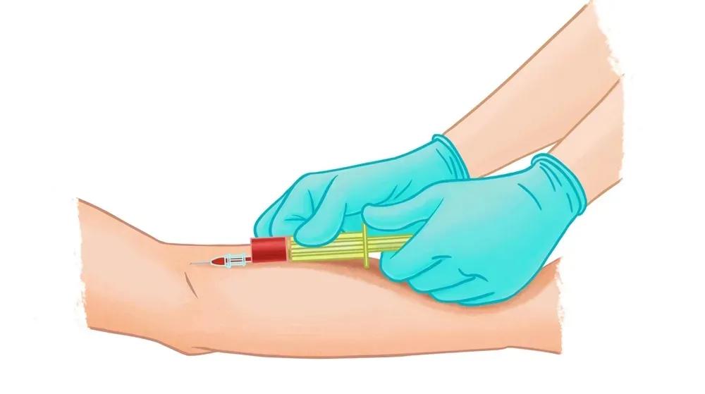 手指关节疼肿胀变形要警惕四种病,手指关节变形是风湿吗吃什么药