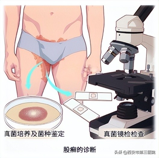 难言之隐到底是什么,难言之隐有多厉害