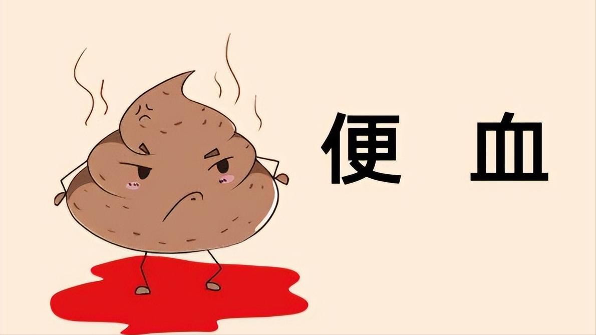 26岁女孩多次肛裂,女性哪些生活习惯会引发肛裂