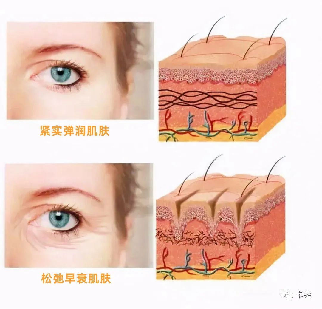 羊胚胎素冻干冰晶眼部精华液，平干纹，淡黑圈，收眼袋，美目传情