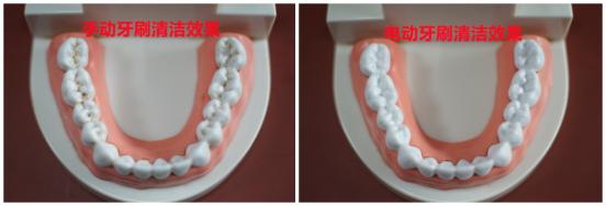 电动牙刷伤牙吗,电动牙刷对补过的牙有影响吗