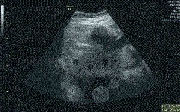 结婚登记不上显示已经结婚,登记结婚时婚姻状况未标明怎么办