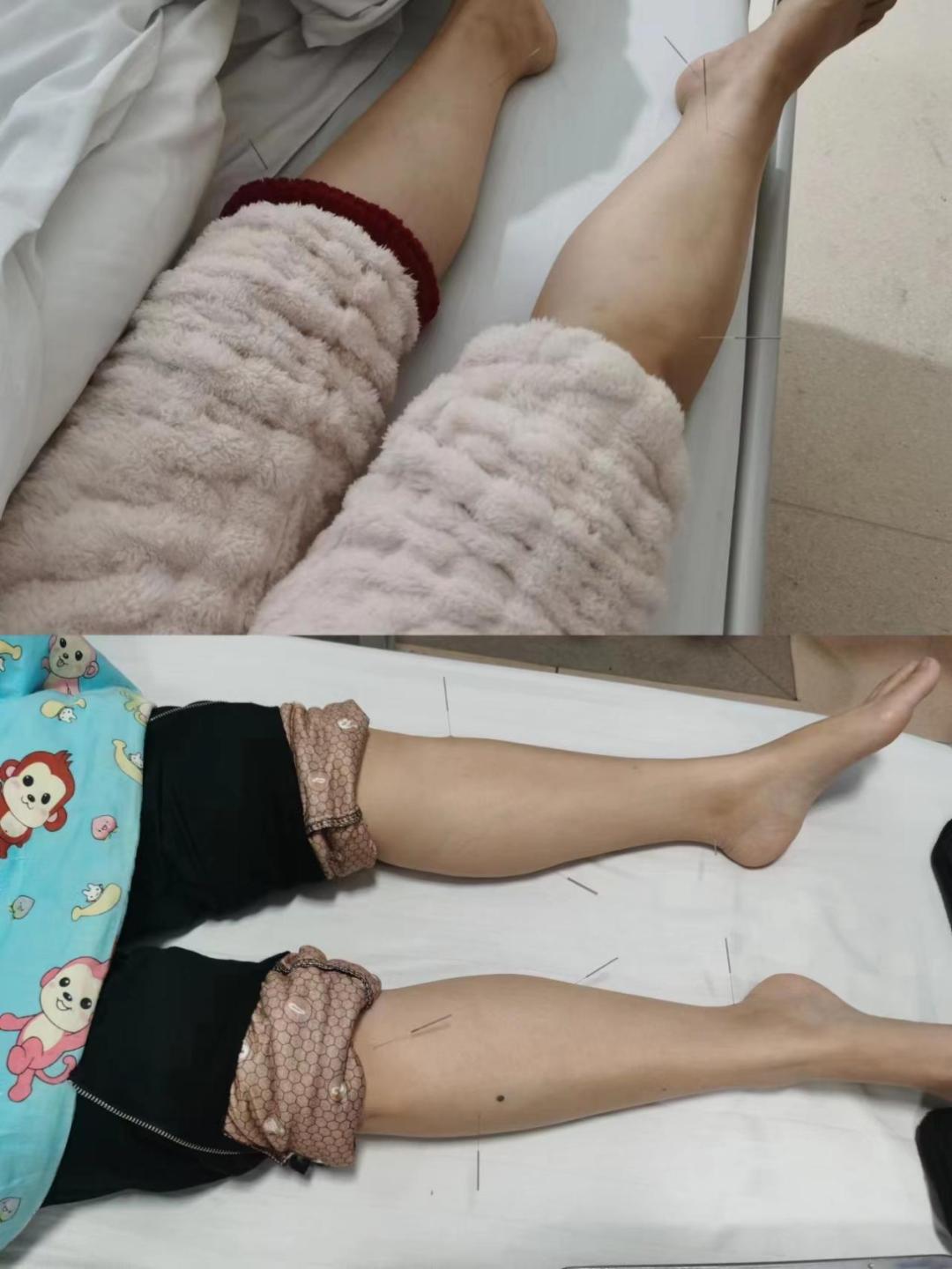 治化疗后手脚麻木的偏方,化疗后手脚麻用什么中药洗有效