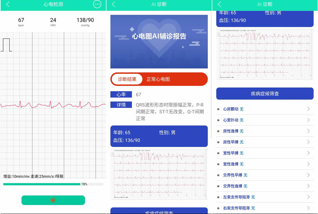 didoe10智能手表评测,didoF50智能手表血压测评