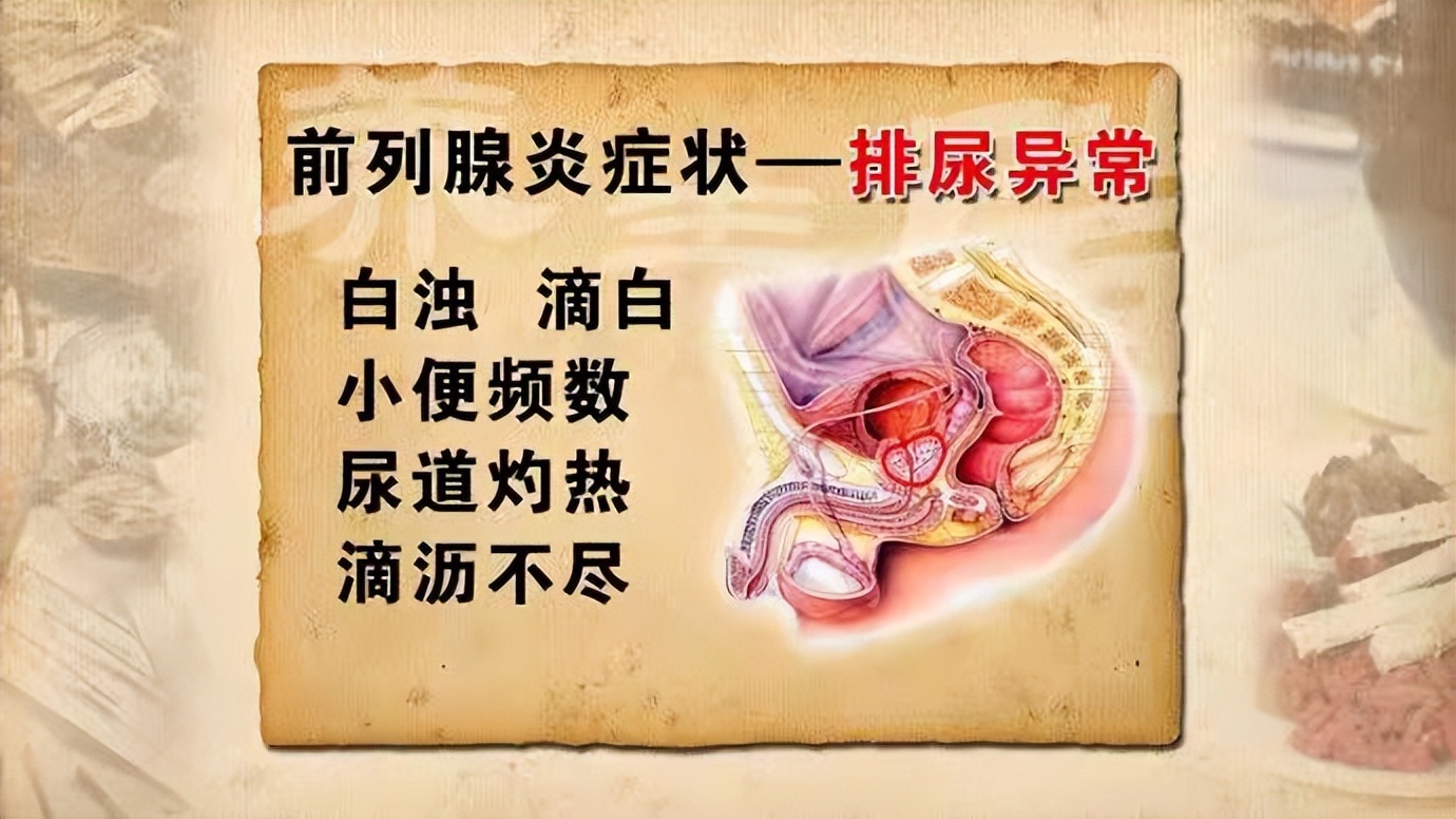 60岁男性尿道口滴白是什么原因,前列腺增生引起尿道滴白厉害吗