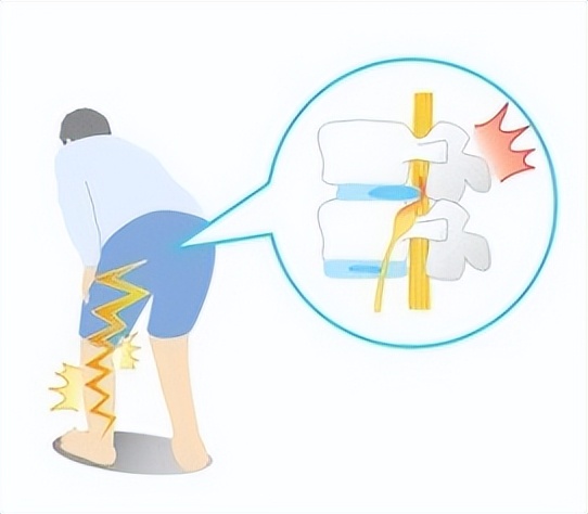 兰州市慢性疼痛实用诊疗技术,兰州二院疼痛科专门治什么病
