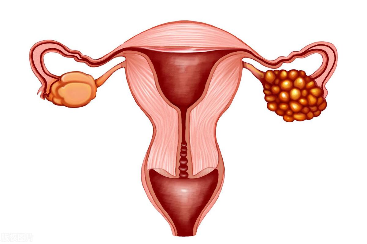 我奶奶69岁，突然月经回来了？不会生病了吧？