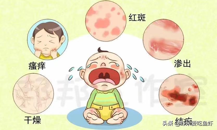 新生儿湿疹的最快最有效土办法,新生儿湿疹怎么去除最简单方法