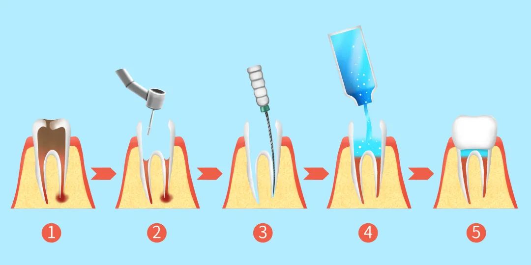 牙齿松了怎么补救最快,牙齿松了能补救吗