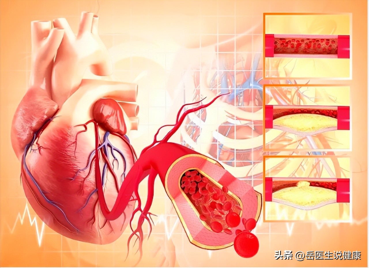 肺癌引起肩疼和一般肩疼区别,肩痛可能是肺癌早期
