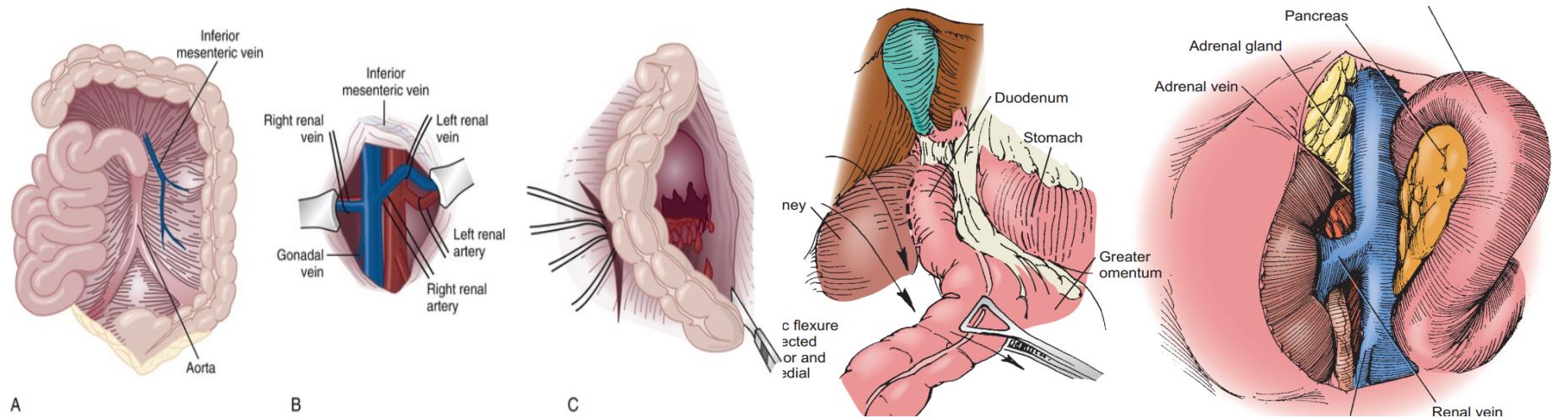 钝性闭合性肾损伤的诊治策略