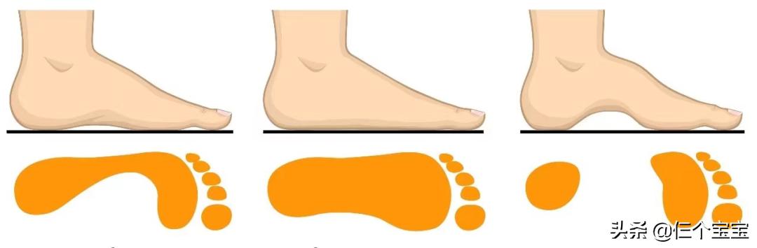 网红踩屎感洞洞鞋防滑,儿童踩屎感椰子鞋