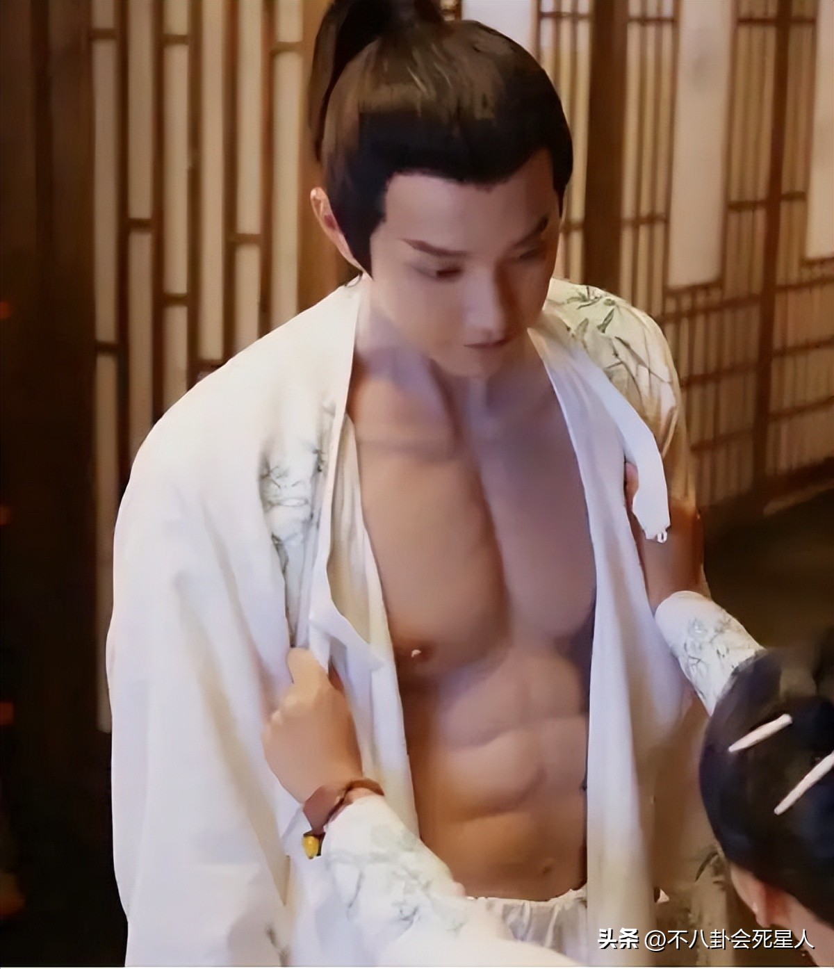 假双眼皮的明星,明星的假脸