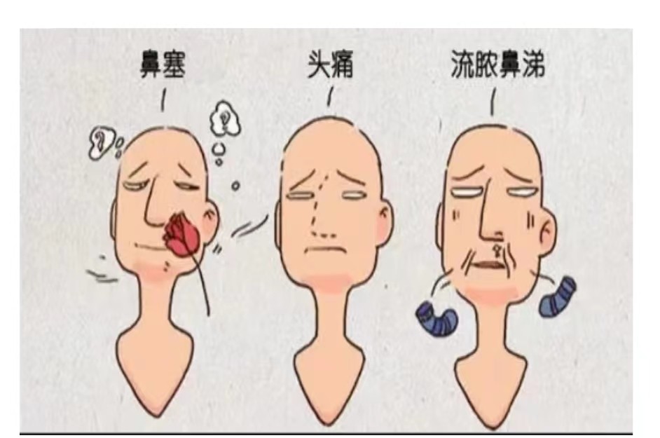 春天来了，当心过敏性鼻炎