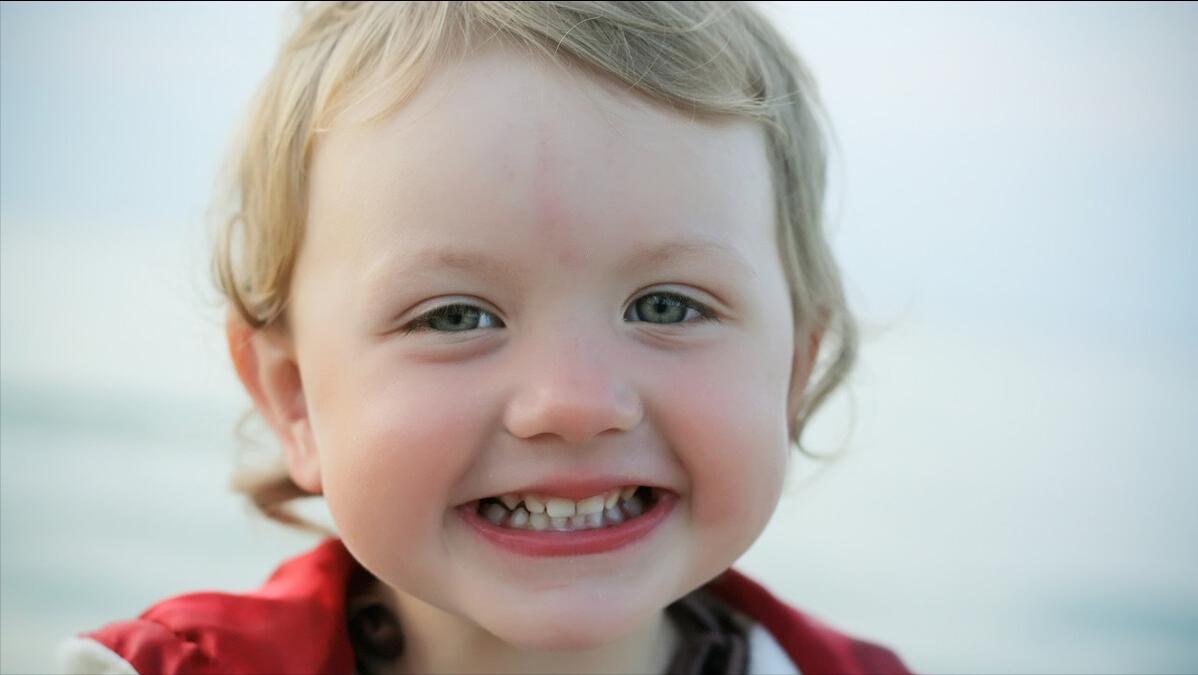 普萘洛尔可以用来治疗血管瘤吗,普萘洛尔治疗血管瘤的注意事项