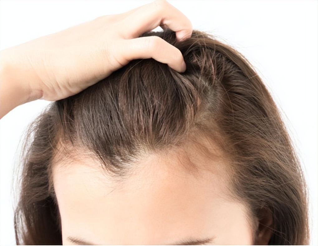 头皮上摸到一个硬疙瘩,头皮有小疙瘩摸着疼怎么回事