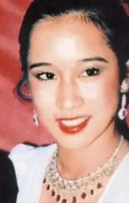 烤瓷牙的明星,烤瓷牙的明星都有谁