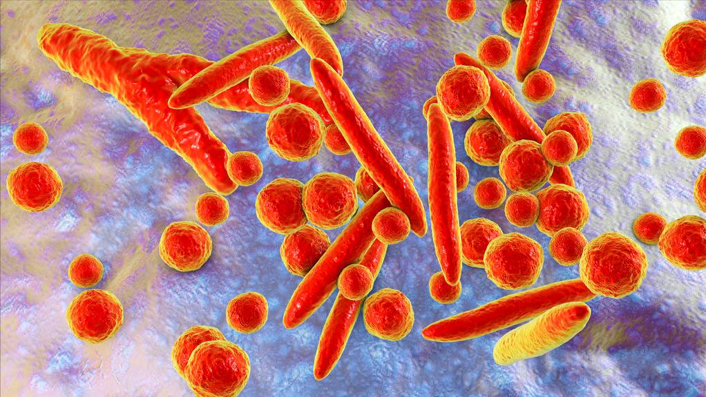 备孕前发现“支原体阳性”，对怀孕影响大吗？别怕，医生帮你应对