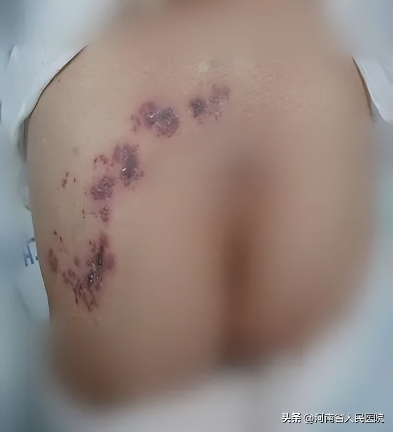 医生画鬼画符,医生鬼画符视频