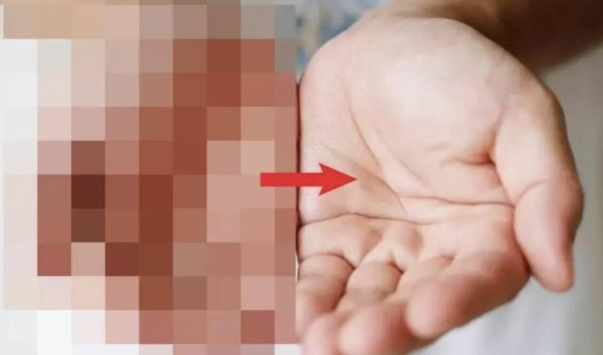 打码的图片能弄掉吗,打码的图片手机如何消码