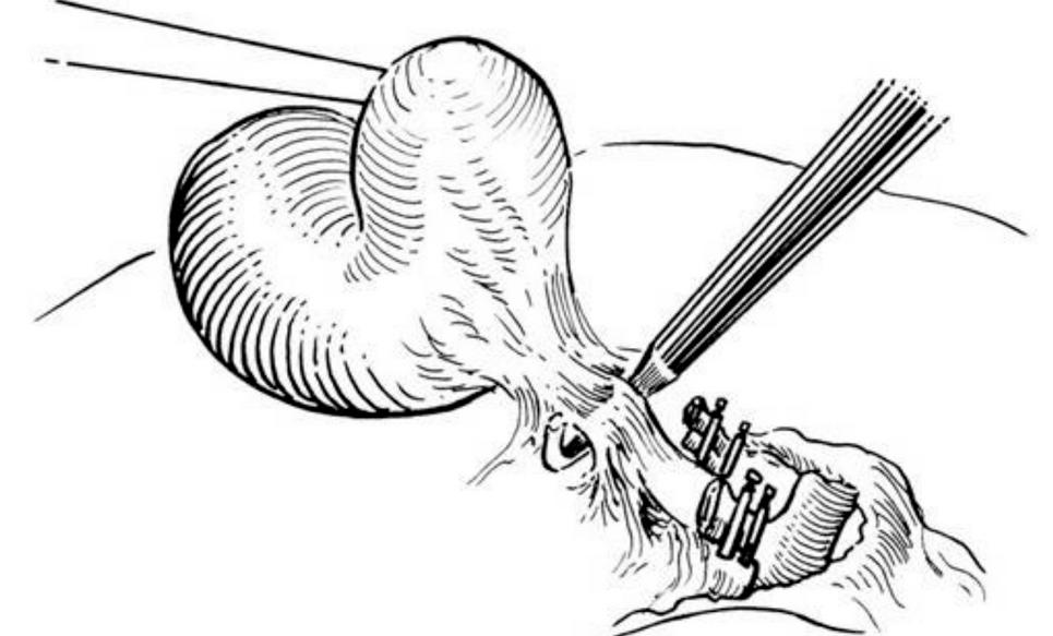 胆囊出现问题身体会出现哪些症状,人没了胆会有哪些症状