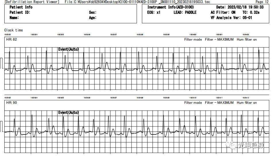 足球感人瞬间心脏发生骤停,2004足球运动员心脏骤停事件
