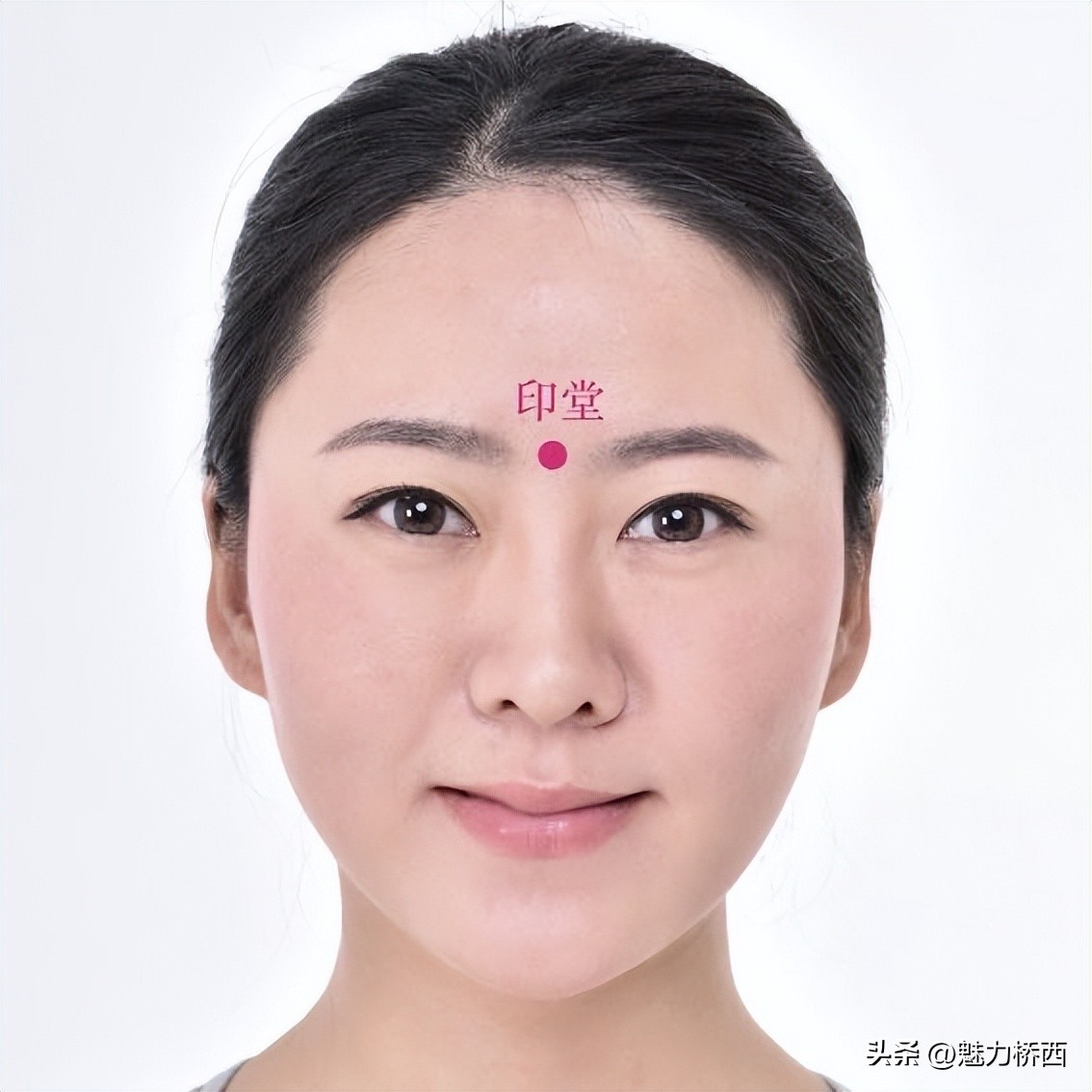 阳康之后头痛怎么办,阳康之后一直头疼是怎么回事